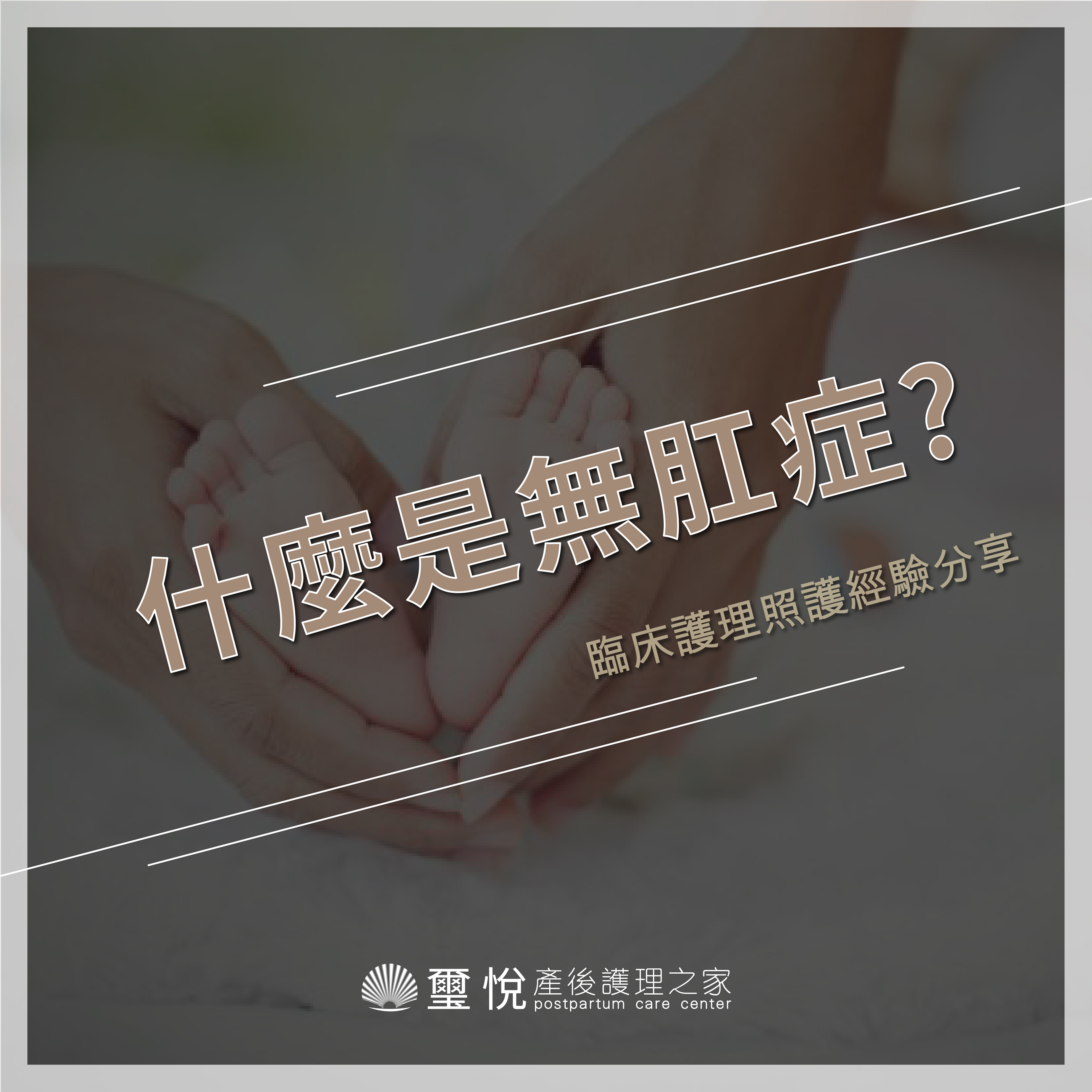 臨床護理照護經驗分享－無肛症