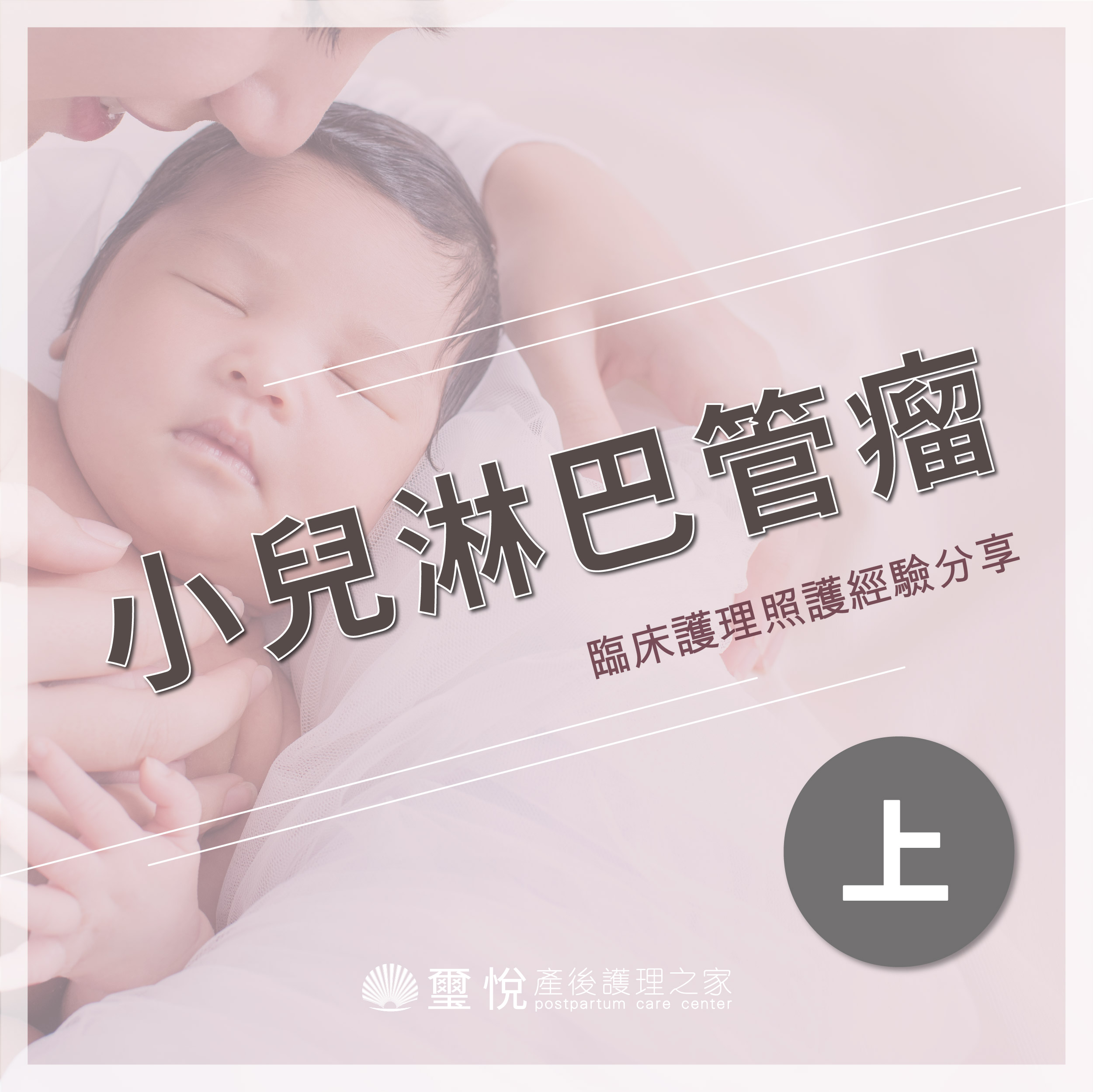臨床護理照護經驗分享－小兒淋巴管瘤（上）