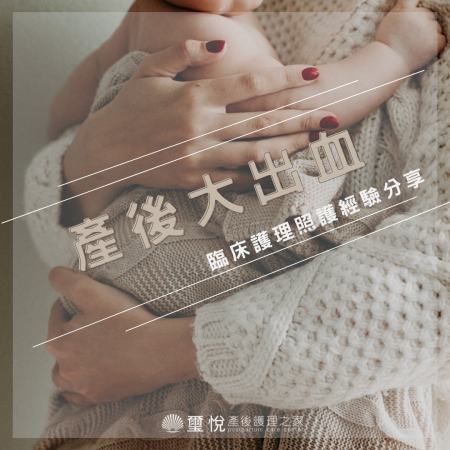 臨床護理照護經驗分享－產後大出血