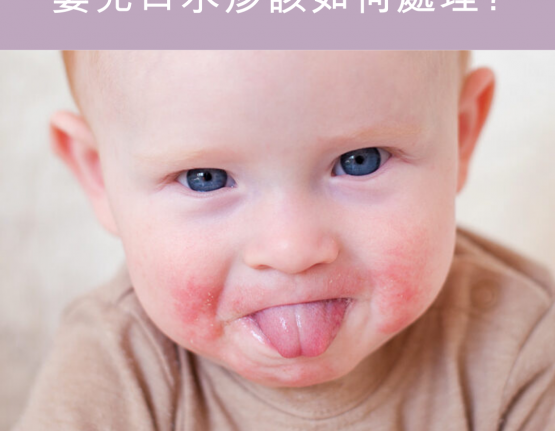 常見的嬰兒口水疹